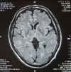 brain080811-01.jpg (105524 oCg)